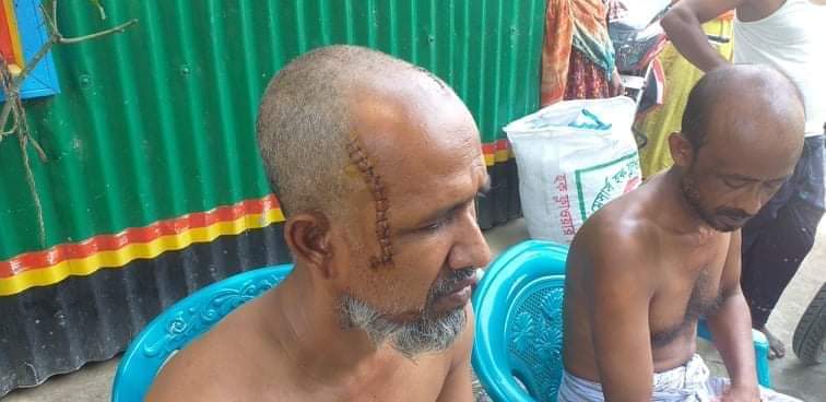 নাগরপুরে সন্ত্রাসী হামলায় মহিলা সহ গুরুতর আহত ১২।