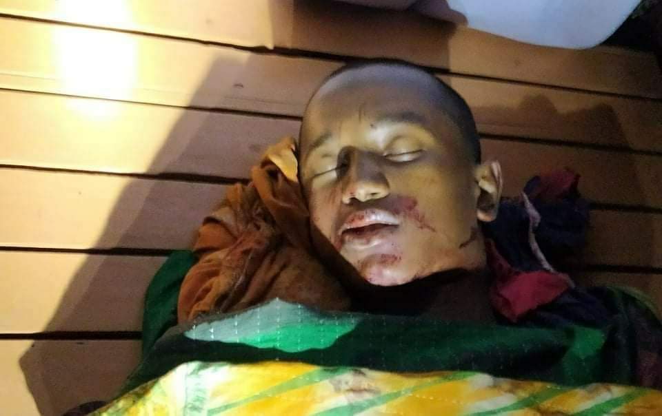 আলফাডাঙ্গায় ইটের দেয়াল ধসে ৭ম শ্রেণির শিক্ষার্থী নিহত।