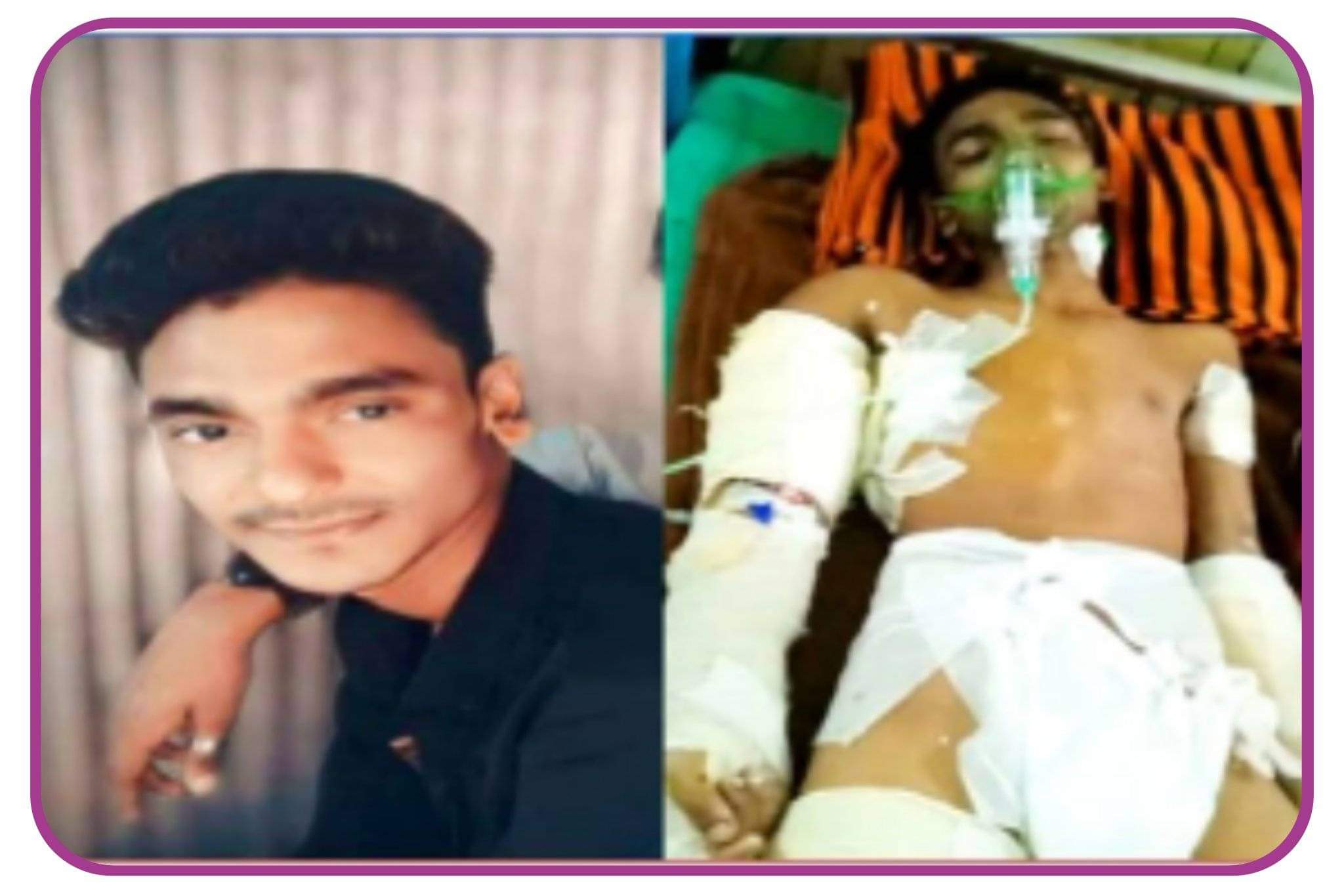 যশোরের শার্শায় পূর্ব শত্রুতার জেরে যুবককে কুপিয়ে জখম