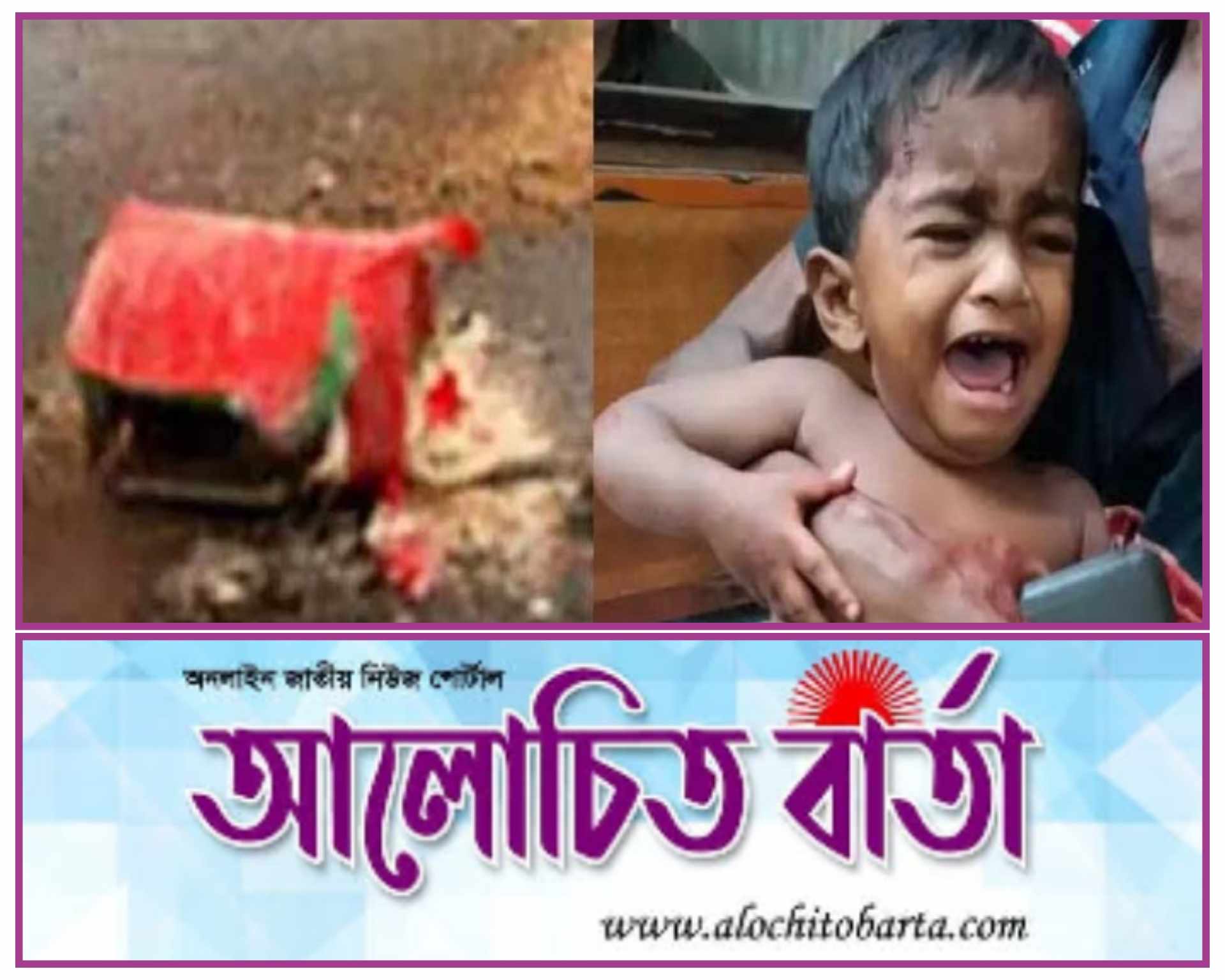 আহত ৫ বছরের শিশু খাদিজার মৃত্যু ককটেল ঘিরে রহস্য।