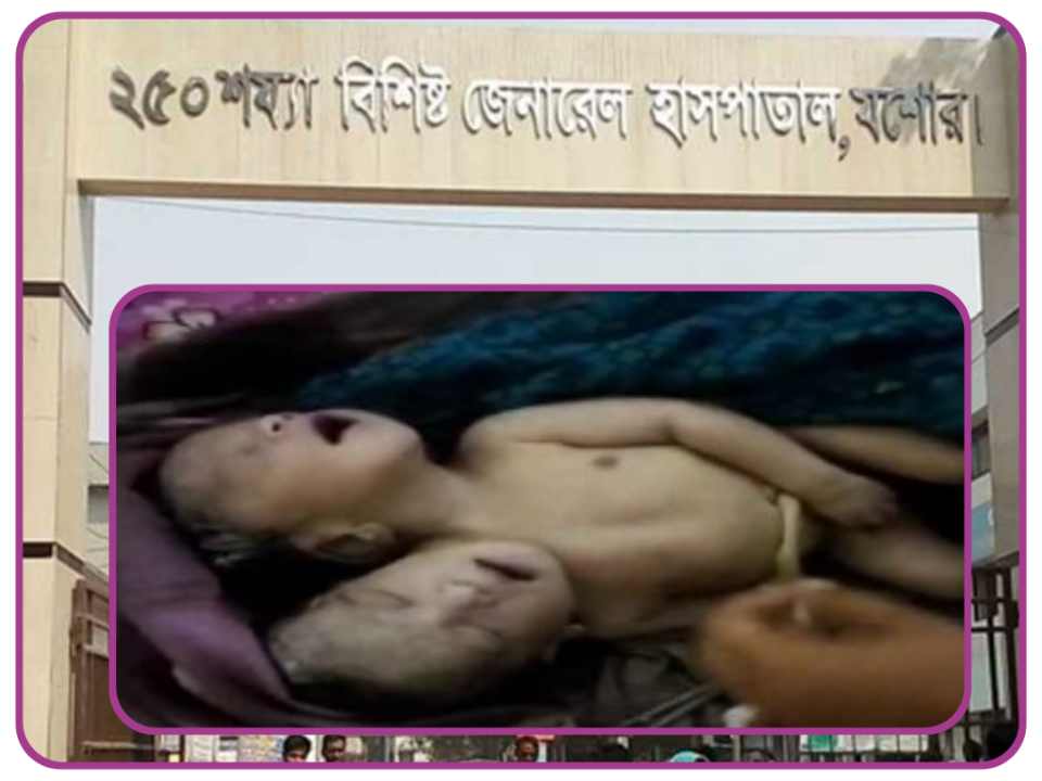 যশোর শার্শা বাগআঁচড়ায় দুই মাথা নিয়ে এক ছেলে শিশুর জন্মের কিছুক্ষন পর ই মৃত্যু